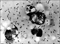 The bubonic plague bacteria taken from a patient. At least eight people have died from an outbreak of bubonic plague in northwestern China but authorities said the disease has been brought under control, state media reported