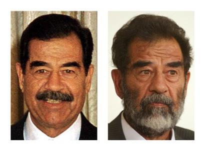 Saddam suffers from prostate infection