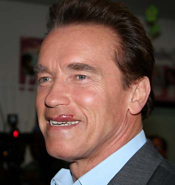 Arnold Schwarzenegger back to work after injury