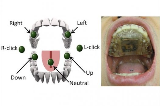 残疾人可用舌头操控轮椅！美研发易于操作驱动系统
