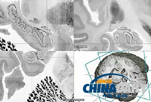 科学家绘制出3D人脑高清模型 或可助治神经疾病