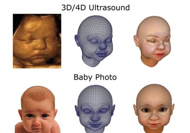 3D打印带你见未出生胎儿！体位表情皮肤性别皆可见