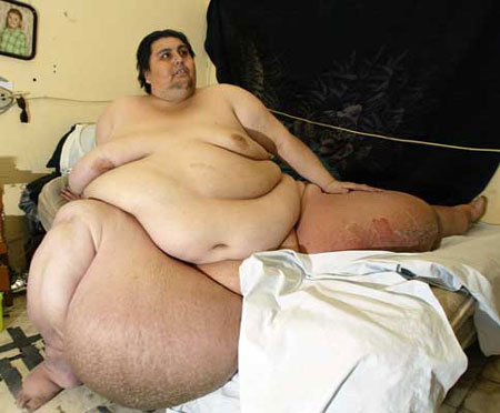 Manuel Uribe, the world's fattest man, according to the Guinness Book of Records, pictured in 2006, proudly announced Tuesday he dropped 230 kilograms (570 pounds), nearly half his original weight in less time than doctors had expected. [Agencies]