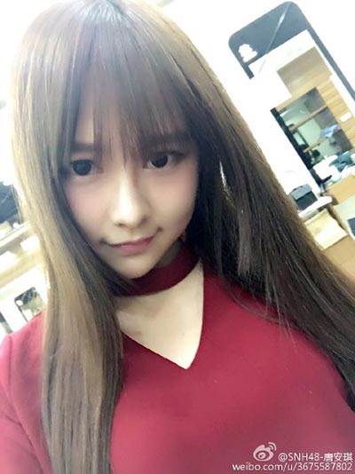 SNH48 member suffers flame burn injury