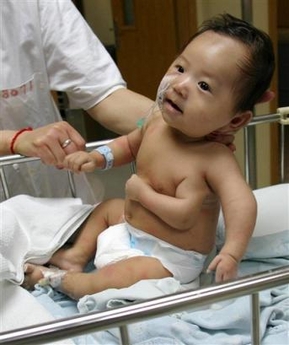 A doctor inspects a 59-day-old baby boy who was born with three arms, at a hospital in Shanghai, in east China Monday, May 29, 2006. Doctors are checking the boys physical condition before deciding whether to remove his third arm. [AP]
