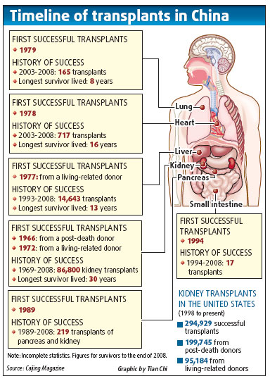 Four in five die in waiting for organ donation