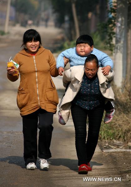 Girl, 2 years old, weighs 45kg