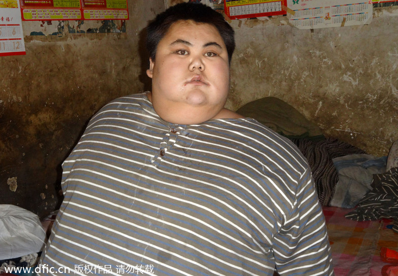 Fattest person in China dies of heart failure