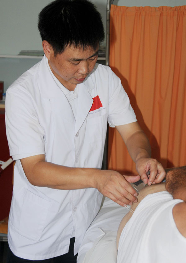 Acupuncture treatment in Malta