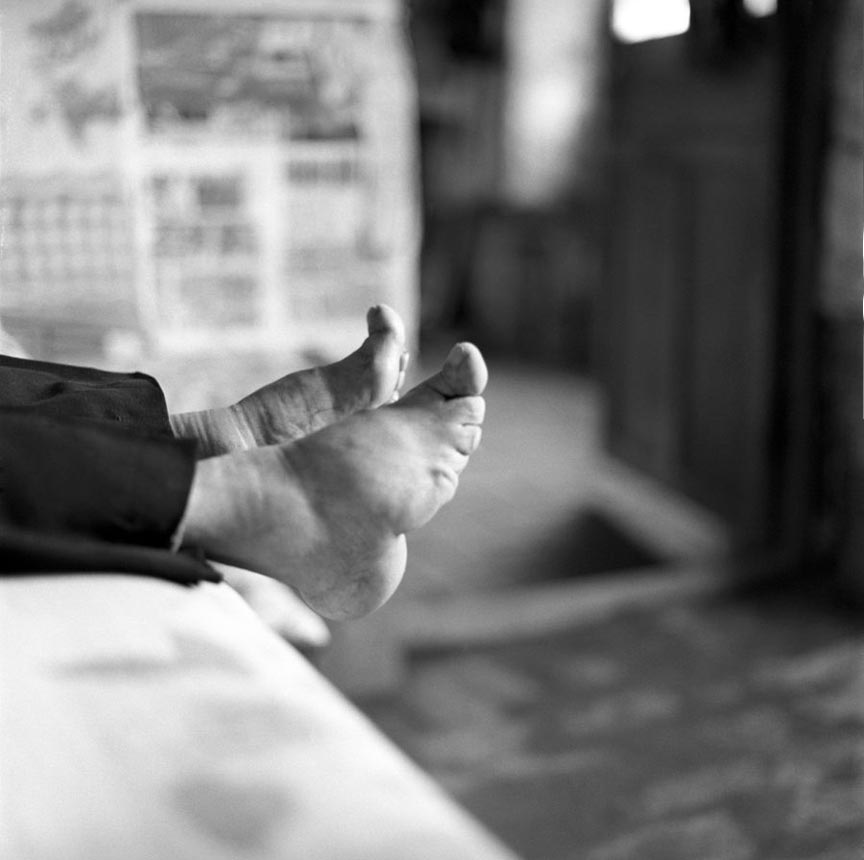 Chinese women with bound feet