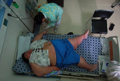 “中国第一胖”梁用在医院的日子