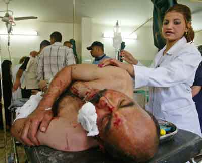 An Iraqi man injured in a car bomb explosion is treated by a nurse at Baghdad's Yarmouk Hospital April 13, 2005. A car bomb blast near a U.S. military convoy on Wednesday seriously wounded four civilians in one of four blasts to hit the Iraqi capital, sources said. REUTERS