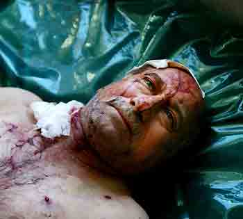 An injured Iraqi man lies in hospital after a road side bomb in Baghdad May 4, 2005. A suicide bomber killed at least 60 people and wounded 150 more when he blew himself up at the office of a Kurdish party in the northern Iraqi city of Arbil on Wednesday, a health official said. [Reuters]