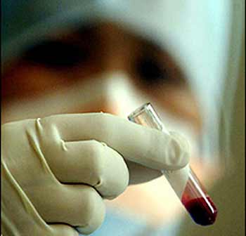 A nurse examines a blood sample. Some 461 people, including 117 children, have been hospitalised in a Hepatitis A outbreak in southwest Russia's Tver region.(AFP/File