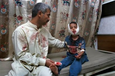 An Iraqi boy receives treatment for head wounds he received in an explosion at a mosque, Friday Aug. 12, 2005, in Al-Nasaf, 25 kms. (15 miles) east of Ramadi, central Iraq.