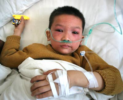 A boy receives treatment at a local hospital after getting injured in a primary school stampede in Tongjiang County in Southwest China's Sichuan Province October October 25, 2005. [newsphoto]