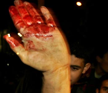 A Palestinian man raises his bloodied hand after an Israeli air strike in the Jabalya refugee camp, north of Gaza Strip, October 27, 2005.