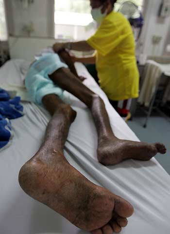  nurse attends to a dying patient in the 'final stages' ward of a hospital inside the Buddhist Prabat Namphu Temple in central Lopburi province, 150 km (93 miles) northeast of Bangkok, November 28, 2005.