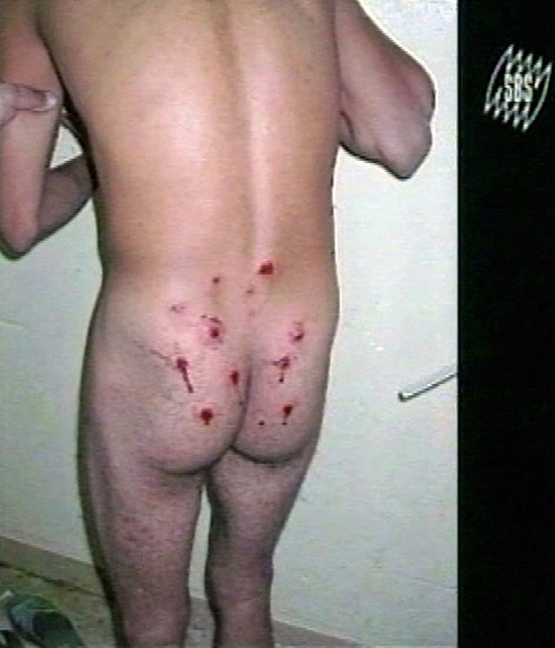 New photos of Abu Ghraib abuse surface