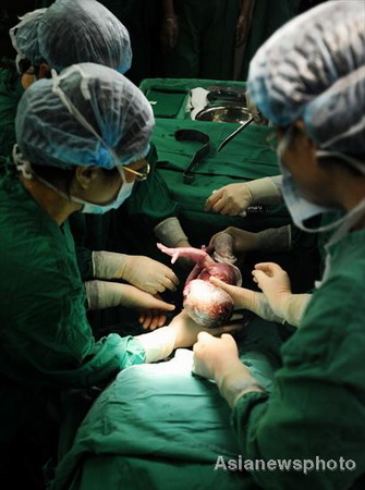 Mother gives birth to quadruplets in Central China