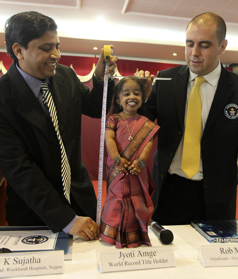 World's shortest living woman