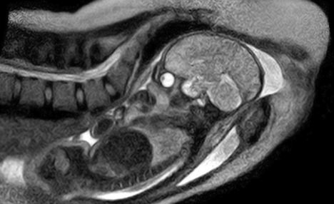 德国利用核磁共振成像拍出全球首套婴儿降生图片