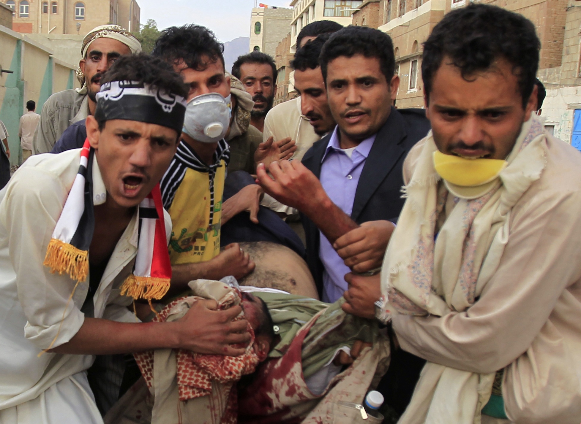 也门最严重冲突致数百人死伤 “失道寡助”或被盟友抛弃