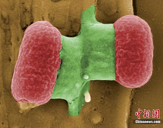 欧洲大肠杆菌源头再度成谜 沼气厂疑是病菌温床