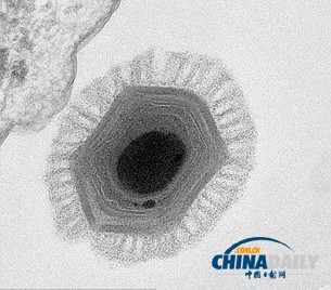 法国科学家发现前所未见的巨型病毒 或来自火星