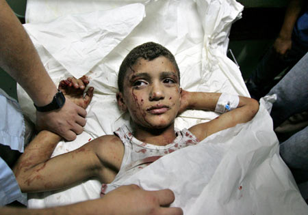 Palestinian 
medics treat a boy wounded by an Israeli airstrike in Gaza City July 8, 2006. Palestinian Prime Minister Ismail Haniyeh called for a halt to fighting on Saturday hours after Israel, whose forces have killed over 40 Palestinians in recent days, withdrew from most of the northern Gaza Strip.[Reuters] 