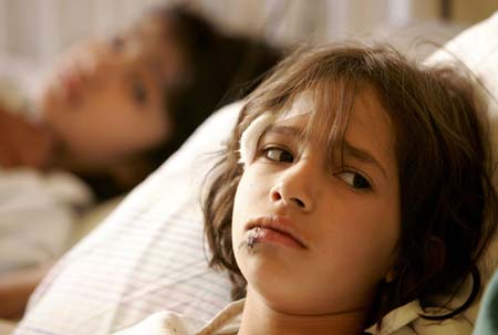 Seven-year-old Tia Mazloum, who was injured in an Israeli air strike in the village of Pritel during the conflict between Israel and Lebanon's Hizbollah, lies on a bed at a hospital in the city of Baalbeck, north of Beirut August 14, 2006. 