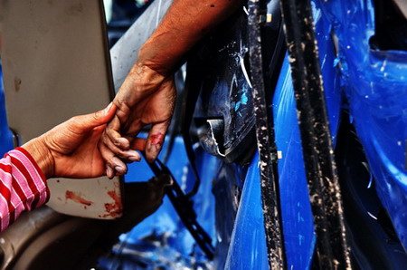 A relative holds the hand of a victim of a road accident in Changsha, Central China's Hunan Province, June 8, 2006. [Qin Lou/Xiaoxiang Morning News]