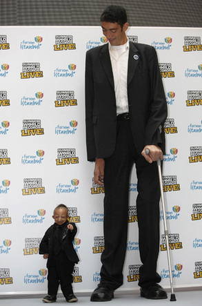 World's shortest man dies at 21