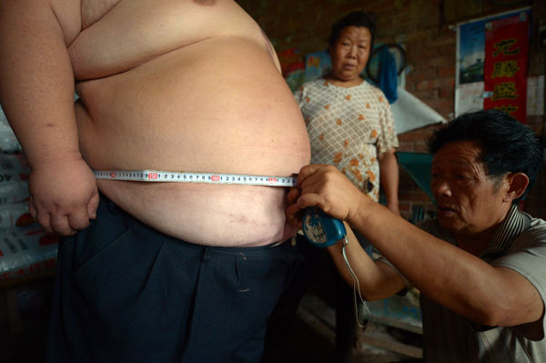 At 180kg, man becomes Chongqing's heaviest