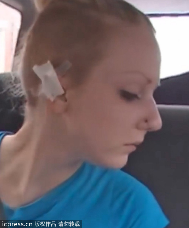 Canadian woman has ears cut like an elf