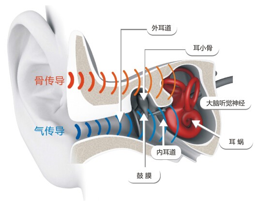 骨传导相关涨停背后，关于AfterShokz这头深海蓝鲸