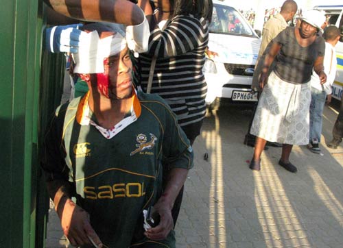 15 hurt in stampede at South Africa pre-World Cup friendly