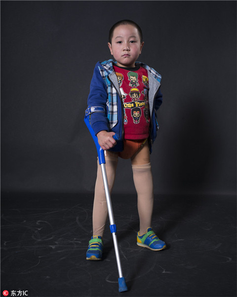 Disabled <EM>Little Apple</EM> star continues to shine