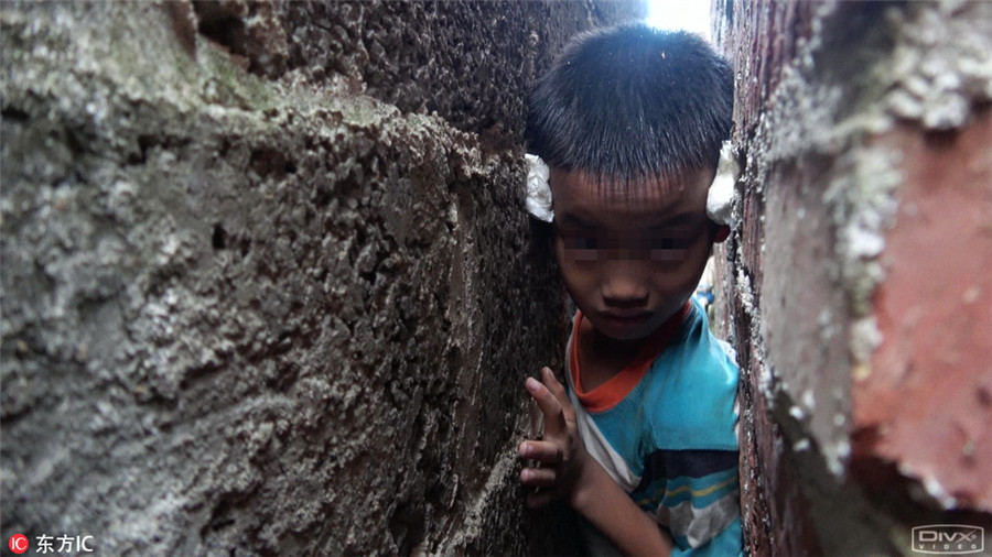 Left-behind boy gets stuck in 20-cm-wide gap