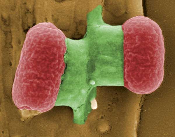 EHEC bacteria under electronic microscope