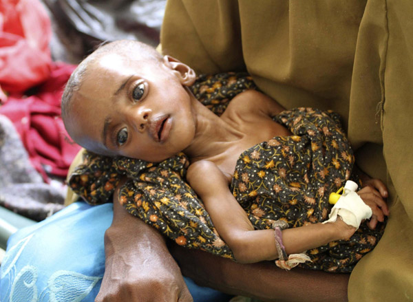 Life in the famine-hit Somalia
