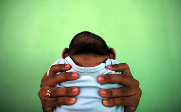 Brazil finds Zika virus in brains of babies born with microcephaly