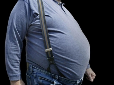 Overweight workers cost their bosses more in injury claims than their lean colleagues, suggests a study that found the heaviest employees had twice the rate of workers' compensation claims as their fit co-workers. (AP