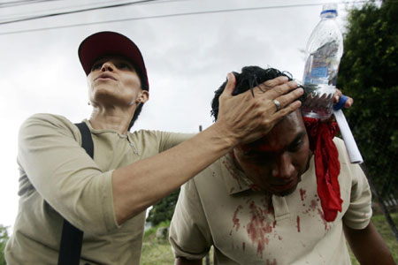 60 injured, 1 dead after Honduras soldiers, protesters clash