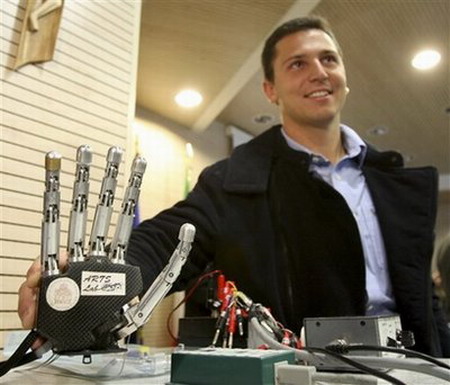 Experts: Man controlled robotic hand with thoughts