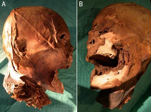 Scientists identify the head of France's King Henry IV