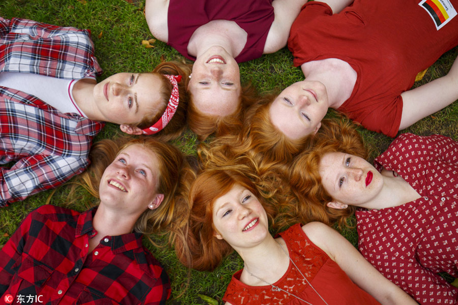 International Redhead Day marked in Dutch city